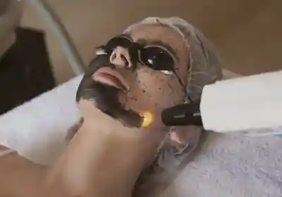 Hollywood Black Peel