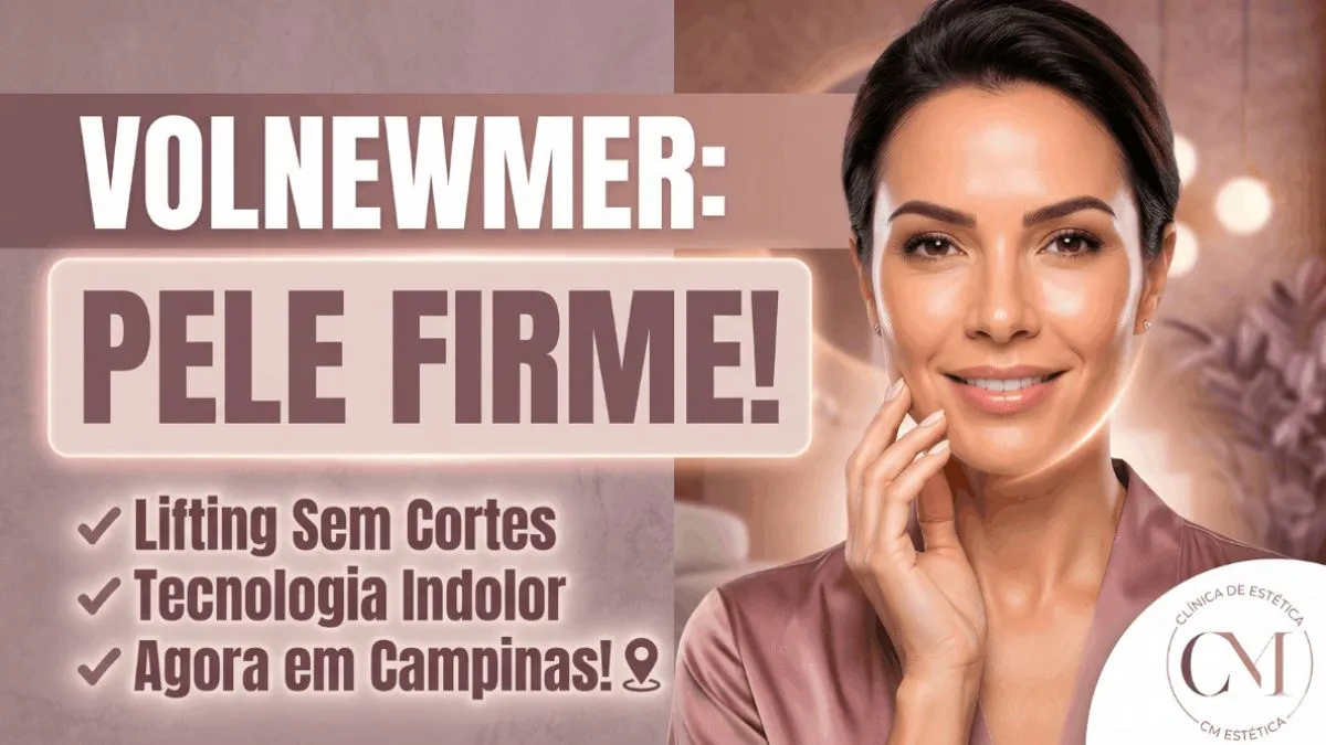 Tratamento com Volnewmer em Campinas: Conheça a Tecnologia Inovadora da CM Estética